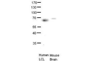 ETS2 antibody - middle region  validated by WB using human LCL and mouse brains at 1:1000. (ETS2 antibody  (Middle Region))