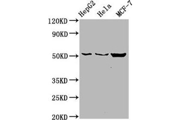CDS2 Antikörper  (AA 354-445)