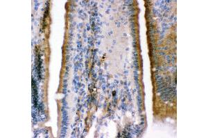 Anti- KCNMA1antibody,IHC(P) IHC(P): Mouse Intestine Tissue (KCNMA1 antibody  (AA 124-467))