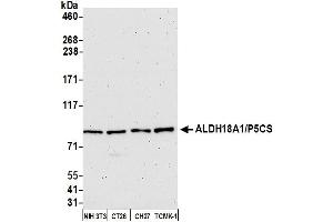 anti-Aldehyde Dehydrogenase 18 Family, Member A1 (ALDH18A1) (AA 575-625) antibody