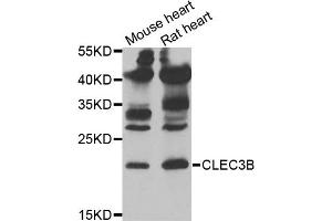 Western blot analysis of extracts of various cell lines, using CLEC3B antibody (ABIN5973819) at 1/1000 dilution.