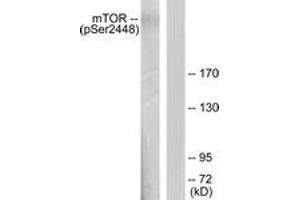 Western blot analysis of extracts from HeLa cells treated with EGF 200ng/ml 30', using mTOR (Phospho-Ser2448) Antibody. (MTOR antibody  (pSer2448))