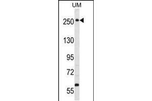 Western blot analysis in uterus tumor cell line lysates (35ug/lane). (WNK3 antibody  (C-Term))