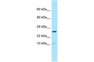 WB Suggested Anti-SPRN Antibody Titration: 1. (SPRN antibody  (N-Term))