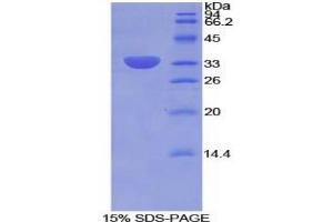 SDS-PAGE analysis of Rat Integrin beta 2 Protein.