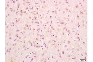 Formalin-fixed and paraffin embedded rat brain tissue labeled with Anti-PCMT1 Polyclonal Antibody, Unconjugated (ABIN715796) at 1:200, followed by conjugation to the secondary antibody and DAB staining (PCMT1 antibody  (AA 165-227))