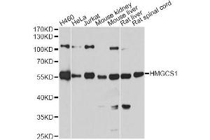 Western blot analysis of extracts of various cell lines, using HMGCS1 antibody (ABIN5972092) at 1:7000 dilution. (HMGCS1 antibody)
