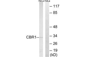 Western Blotting (WB) image for anti-Carbonyl Reductase 1 (CBR1) (Internal Region) antibody (ABIN1851015) (CBR1 antibody  (Internal Region))