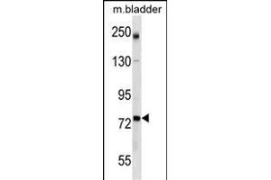 GCLC Antibody (Center) (ABIN1538246 and ABIN2849959) western blot analysis in mouse bladder tissue lysates (35 μg/lane). (GCLC antibody  (AA 286-315))