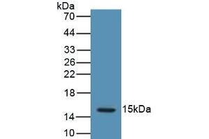 Detection of Recombinant LHb, Human using Polyclonal Antibody to Luteinizing Hormone Beta Polypeptide (LHb) (LHB antibody  (AA 23-141))