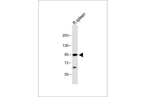 Cbl Proto-Oncogene B, E3 Ubiquitin Protein Ligase (CBLB) (AA 103-130) antibody