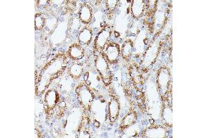 Immunohistochemistry of paraffin-embedded mouse kidney using CDK5R antibody (ABIN7266235) at dilution of 1:100 (40x lens). (CDK5RAP1 antibody  (AA 1-350))