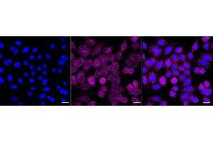 anti-Itchy E3 Ubiquitin Protein Ligase Homolog (ITCH) antibody