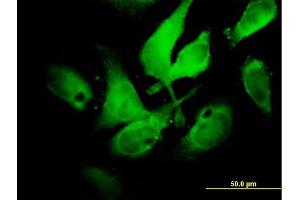 Immunofluorescence of  purified  MaxPab antibody to NCF2 on HeLa cell. (NCF2 antibody  (AA 1-526))