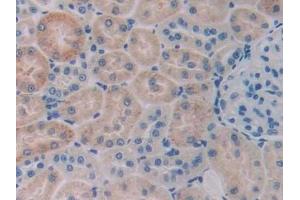 Detection of CBG in Rat Kidney Tissue using Monoclonal Antibody to Corticosteroid Binding Globulin (CBG) (SERPINA6 antibody  (AA 173-344))