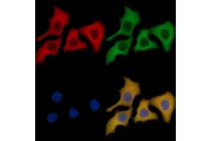 Aurora A Mouse Monoclonal Antibody staining HepG2 cells by IF/ICC.
