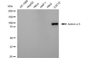 Western blotting analysis using actinin alpha 3 antibody (ABIN7797474).