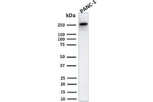 Western Blot Analysis of Human PANC-1 cell lysate using Spectrin beta III Rabbit Recombinant Monoclonal (SPTBN2/2894R). (Recombinant Spectrin, Beta, Non-erythrocytic 2 (SPTBN2) (AA 356-475) antibody)