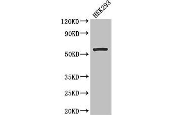 MLYCD Antikörper  (AA 40-493)