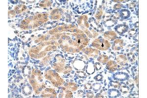 PDE9A antibody was used for immunohistochemistry at a concentration of 4-8 ug/ml.