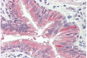 Human Lung, Respiratory Epithelium: Formalin-Fixed, Paraffin-Embedded (FFPE) (EPS8-Like 2 antibody  (AA 1-50))