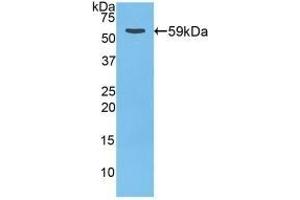 Detection of Recombinant CTSD, Rat using Polyclonal Antibody to Cathepsin D (CTSD) (Cathepsin D antibody  (AA 120-407))