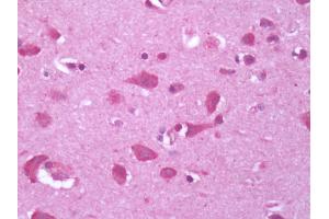 Human Brain, Cortex: Formalin-Fixed, Paraffin-Embedded (FFPE) (GPR34 antibody)