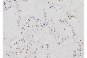 ABIN6276303 at 1/100 staining Human lung tissue by IHC-P. (DDIT3 antibody  (N-Term))
