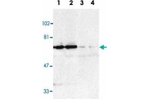 Western blot analysis of TNFRSF21 in K-562 (1, 3) and Raji (2, 4) whole cell lysate in the absence (1, 2) or presence (3, 4) of blocking peptide with TNFRSF21 polyclonal antibody  at 1 : 500 dilution.