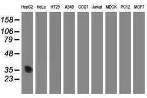 Image no. 3 for anti-Aminoacylase 3 (ACY3) antibody (ABIN1496464) (Aminoacylase 3 antibody)