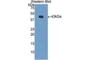 Detection of Recombinant BNP, Human using Polyclonal Antibody to Brain Natriuretic Peptide (BNP) (BNP antibody  (AA 27-121))