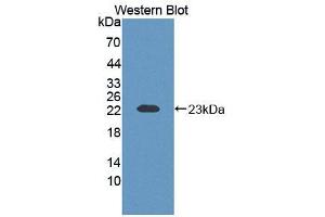 Western blot analysis of the recombinant protein. (ECT2 antibody  (AA 453-647))
