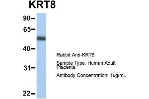 Host:  Rabbit  Target Name:  KRT8  Sample Type:  Human Adult Placenta  Antibody Dilution:  1. (KRT8 antibody  (Middle Region))