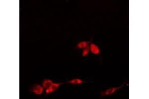 ABIN6275756 staining  HuvEC cells by IF/ICC. (SLC30A9 antibody  (Internal Region))