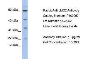 WB Suggested Anti-LMO2  Antibody Titration: 0. (LMO2 antibody  (N-Term))