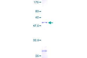 Image no. 1 for Zinc Finger Protein 22 (ZNF22) (AA 1-224) protein (GST tag) (ABIN1325989) (Zinc Finger Protein 22 Protein (ZNF22) (AA 1-224) (GST tag))