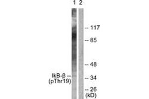 Western blot analysis of extracts from 293 cells treated with TNF-a 20ng/ml 30', using IkappaB-beta (Phospho-Thr19) Antibody. (NFKBIB antibody  (pThr19))