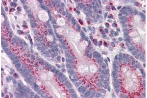 Human Small intestine: Formalin-Fixed, Paraffin-Embedded (FFPE) (GPR3 antibody  (AA 1-331))