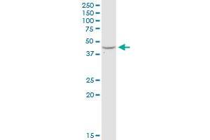 ADA MaxPab rabbit polyclonal antibody. (ADA antibody  (AA 1-363))