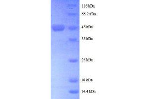 ADP-Ribosylation Factor-Like 2 (ARL2) (AA 19-184), (partial) protein (GST tag)