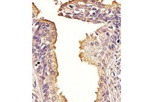 Immunohistochemistry (Paraffin-embedded Sections) (IHC (p)) image for anti-Sequestosome 1 (SQSTM1) (AA 317-346) antibody (ABIN388979)