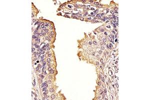 (ABIN388979 and ABIN2850435) staining SQSTM1 in Human prostate tissue sections by Immunohistochemistry (IHC-P - paraformaldehyde-fixed, paraffin-embedded sections). (SQSTM1 antibody  (AA 317-346))