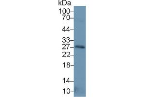 Western Blot; Sample: Human Placenta lysate; Primary Ab: 1µg/ml Rabbit Anti-Human NT3 Antibody Second Ab: 0. (Neurotrophin 3 antibody  (AA 21-138))