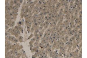Immunohistochemistry (IHC) image for anti-Apolipoprotein B (APOB) (AA 2747-2913) antibody (ABIN7429130)