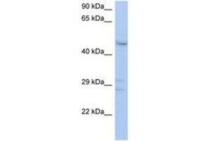 Image no. 1 for anti-PXYLP1 / ACPL2 (AA 143-192) antibody (ABIN6743335) (PXYLP1 / ACPL2 (AA 143-192) antibody)