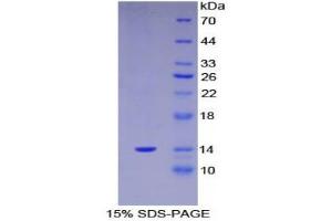 SDS-PAGE (SDS) image for S100 Calcium Binding Protein A11 (S100A11) (AA 1-105) protein (His tag) (ABIN1080698) (S100A11 Protein (AA 1-105) (His tag))