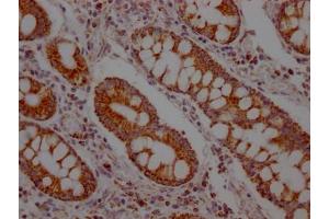 Immunohistochemistry (IHC) image for anti-Solute Carrier Family 16, Member 1 (Monocarboxylic Acid Transporter 1) (SLC16A1) antibody (ABIN7127629)