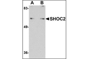 Western blot analysis of SHOC2 in Jurkat cell lysate with this product at (A) 1 and (B) 2 μg/ml.