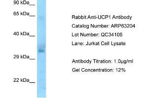 Western Blotting (WB) image for anti-Uncoupling Protein 1 (Mitochondrial, Proton Carrier) (UCP1) (N-Term) antibody (ABIN2789412)