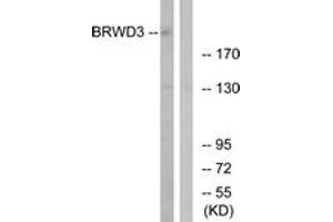 Western blot analysis of extracts from COLO cells, using BRWD3 Antibody. (BRWD3 antibody  (AA 1751-1800))